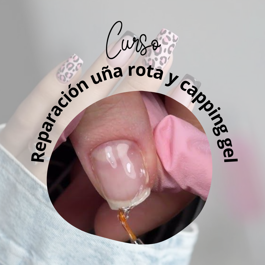 Especialista en capping